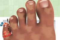 Bli Nageldoktor på några steg i spelvärlden